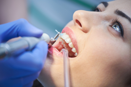 teeth cleaning