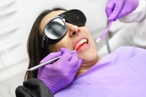 laser gum therapy