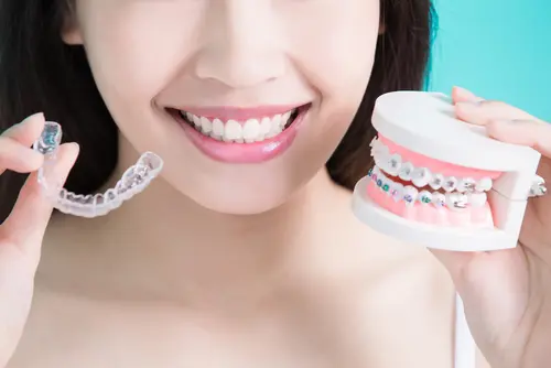 Clear Braces vs. Metal Braces