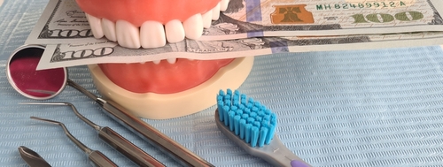 veneers cost