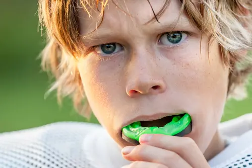 Sports Mouth Guard - Natural Smiles KY